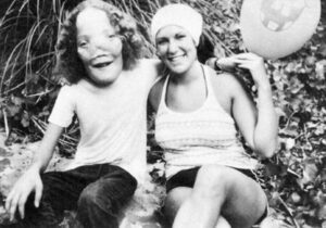 Rocky Dennis: The True Story Behind the Film Mask Rocky and Rusty Dennis