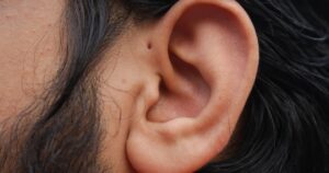 People With a Tiny Hole Above the Ear Have an Exceptionally Rare Trait Small hole in front of the upper side of the ear which is known as Preauricular Pit.