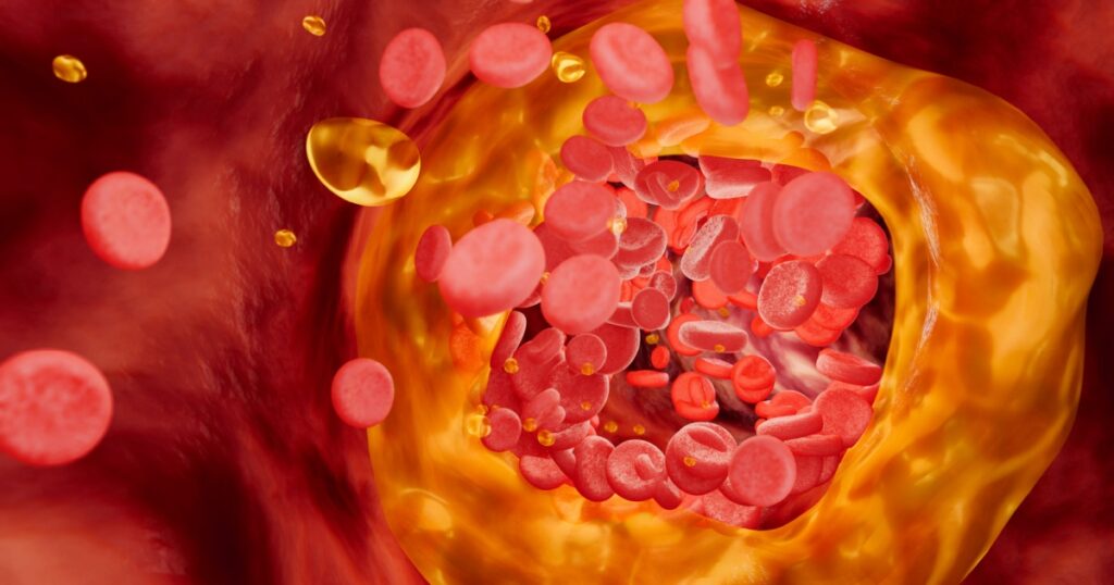 Scientists Are Experimenting With Immunotherapy to Fight Deadly Artery Plaque - Featured image