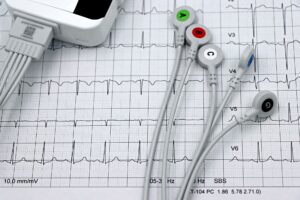 Close-up of ECG monitor leads on a printed cardiogram, showcasing heart health diagnostics.