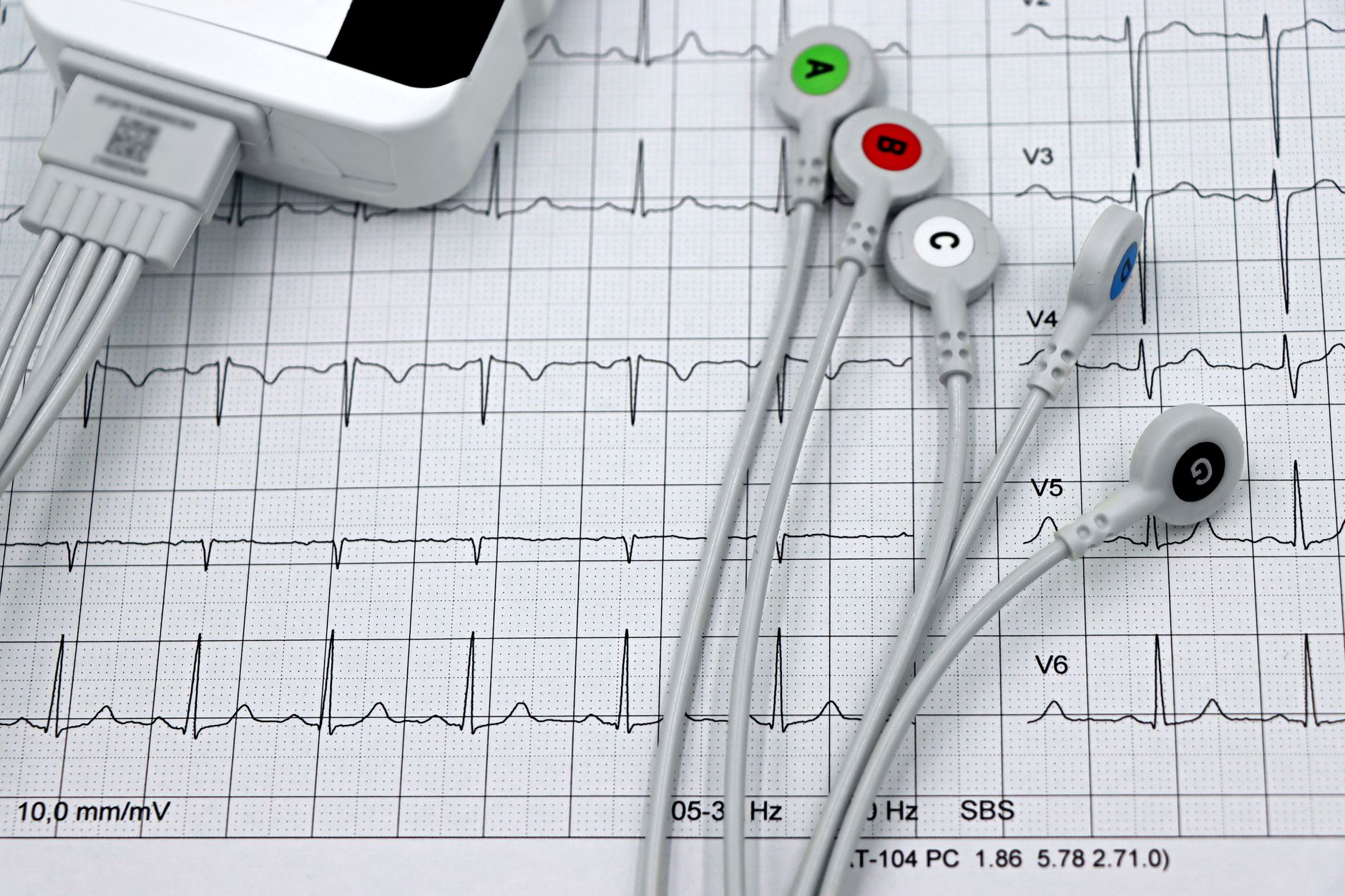 Study Reveals Shocking Connection Between Energy Drinks and Sudden Cardiac Arrest