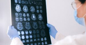 3 Sleep Habits Quietly Accelerating Brain Aging, Study A medical professional reviewing MRI brain scans in a clinical setting, highlighting healthcare technology.