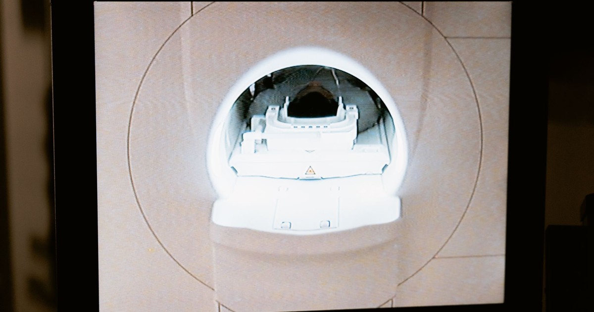 Close-up of an MRI scanner displayed on a monitor in a medical clinic.
