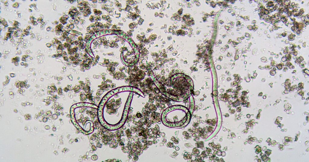 Over 1,400 Hit by ‘Explosive Diarrhea’ Parasite in Michigan and Ohio — No Source Found Yet - Featured image