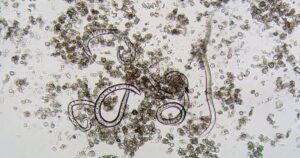The nematode Steinernema feltiae under the microscope, the species used as a biopesticide to infect fungus gnats in agriculture and gardening.