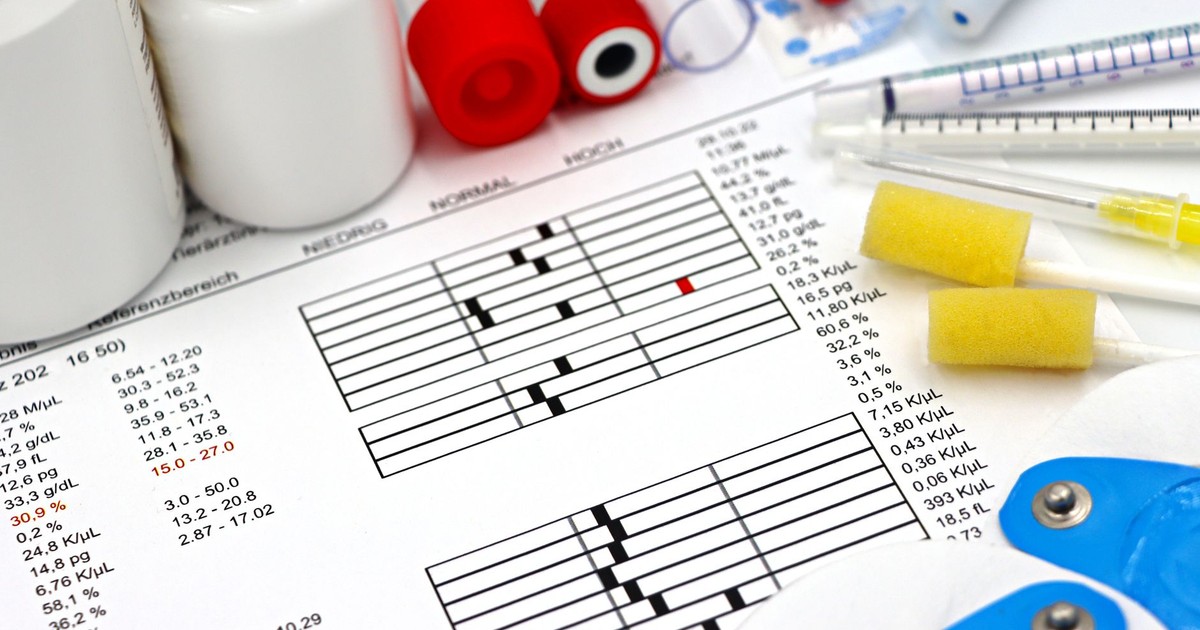 Arrangement of medical equipment, lab tests, and health data on a clinical table.