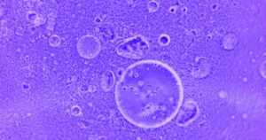 A Hidden Virus Inside a Common Gut Bacterium May Be Linked to Colon Cancer Blue abstract image of water droplets and particles under a microscope.