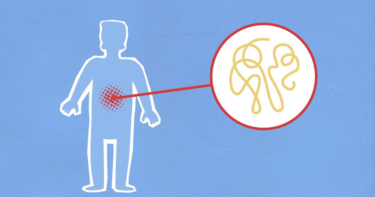Cutout paper composition representing sick human figure with viral infection in stomach on blue background