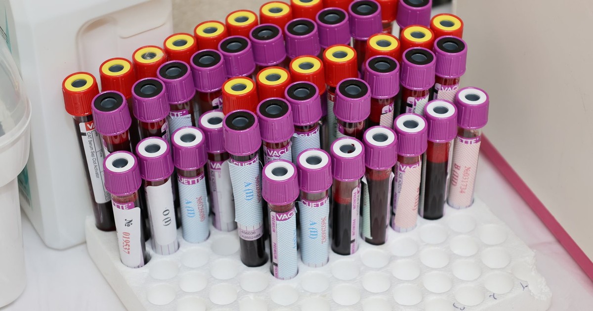 New Alzheimer’s Blood Test Predicts Risk Up to a Decade Before Symptoms Appear