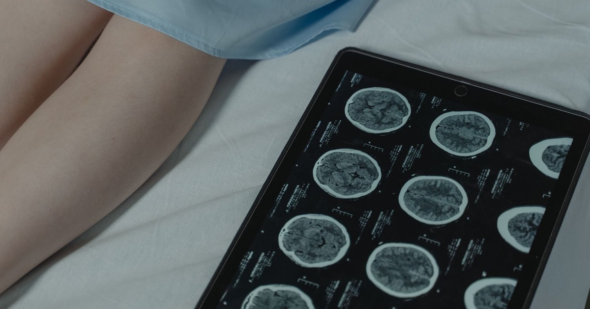 Close-up of brain CT scan display on tablet beside patient's legs in a hospital room.
