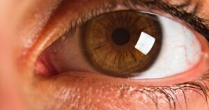 Woman’s Cornea Destroyed by Parasite After Contact Lens Mistake Detailed close-up of a brown eye showcasing the iris, pupil, and eyelashes.