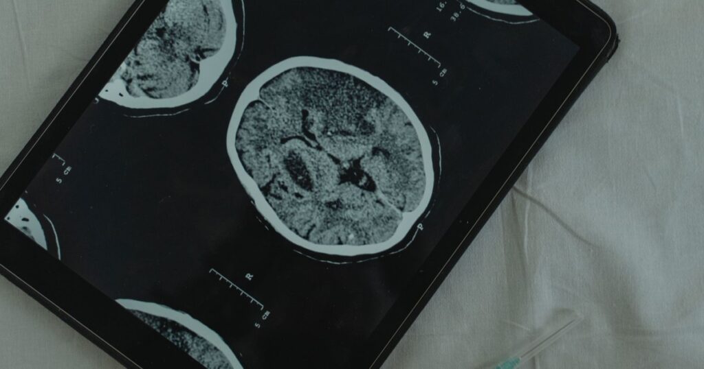 A Hormone in Your Brain May Be Quietly Protecting Your Liver - Featured image