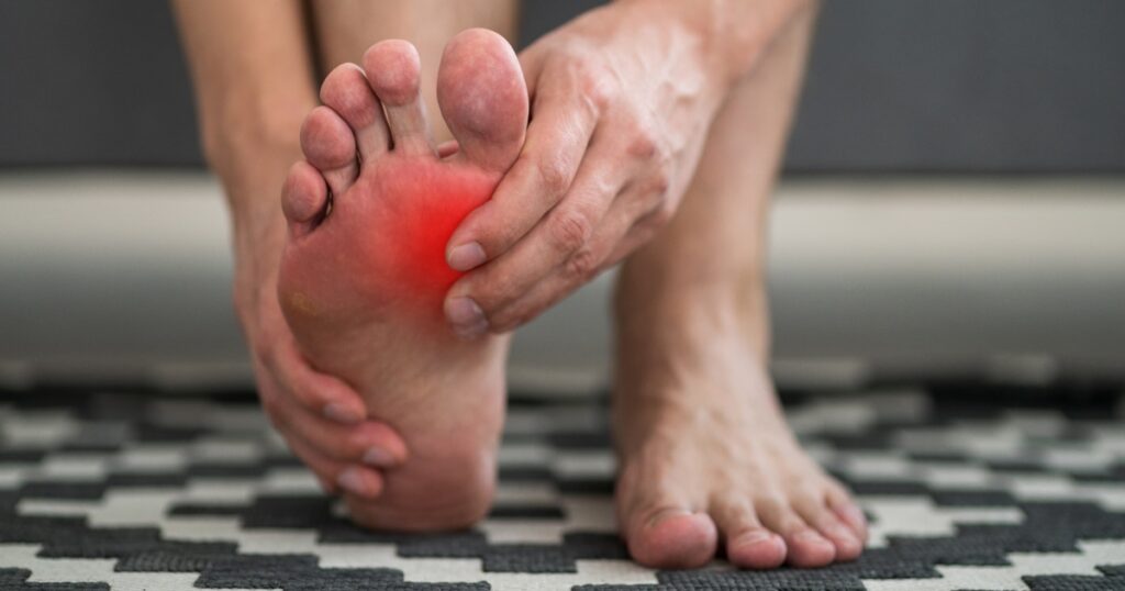 Gout in Young Men Is Surging — Here’s What Scientists Have Found - Featured image
