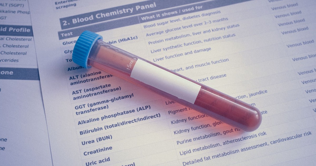 Your Blood Cells May Reveal Hidden Liver Stress Before Symptoms Hit