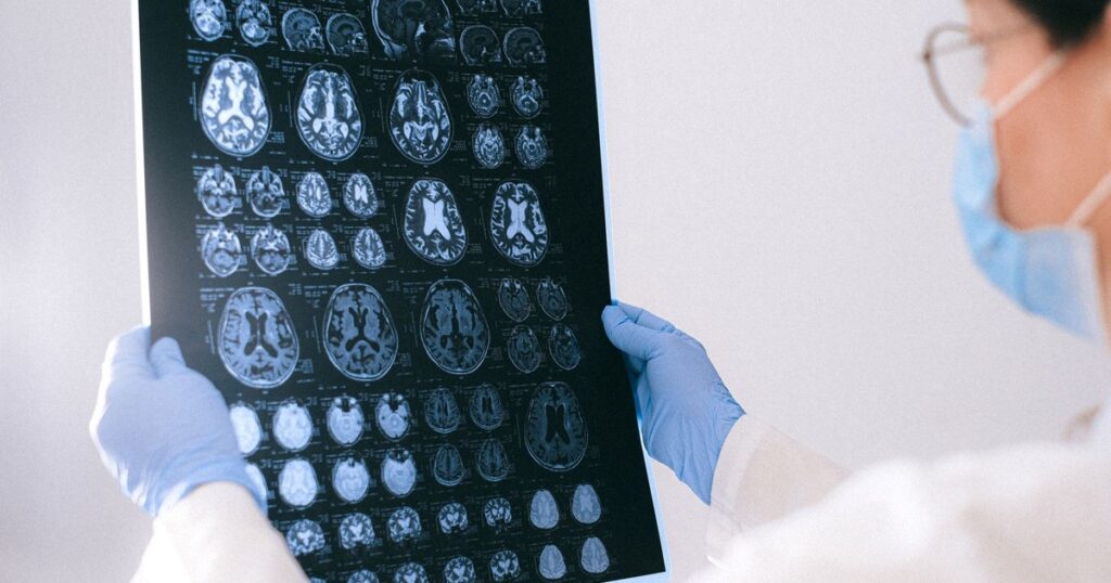 A Newly Discovered Alzheimer’s Trigger Could Point to a Promising Treatment - Featured image