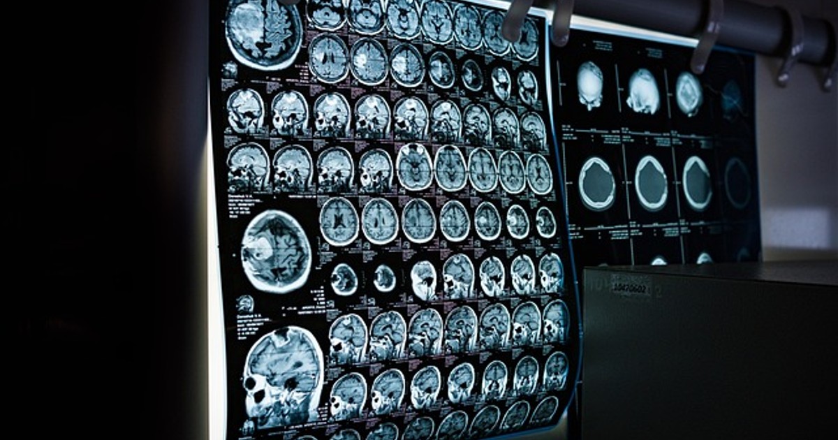 x-ray
