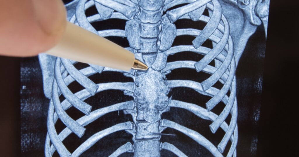 The Organ Doctors Ignored for Decades May Play a Role in How Long You Live - Featured image