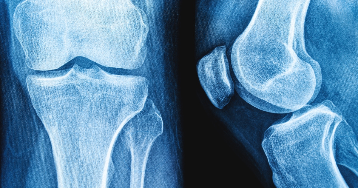 Scientists May Have Found the Switch to Restore Cartilage Growth in Aging Joints