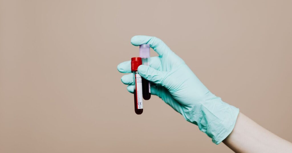 A New Blood Test May Catch Pancreatic Cancer Before Symptoms Appear - Featured image