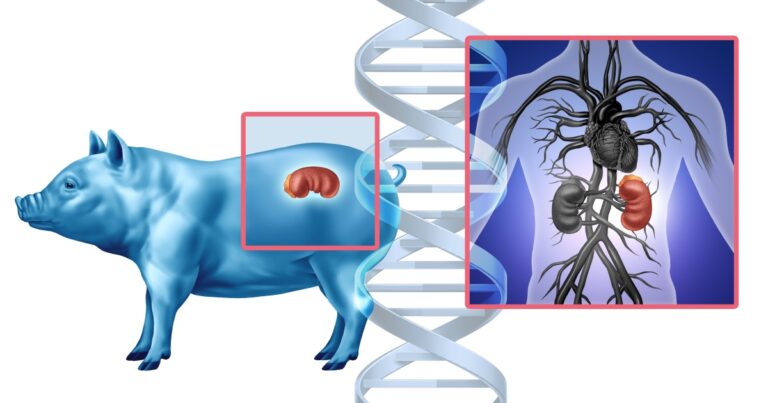 A Pig Kidney Kept This Man Alive for 9 Months — Then He Got a Human One - Featured image